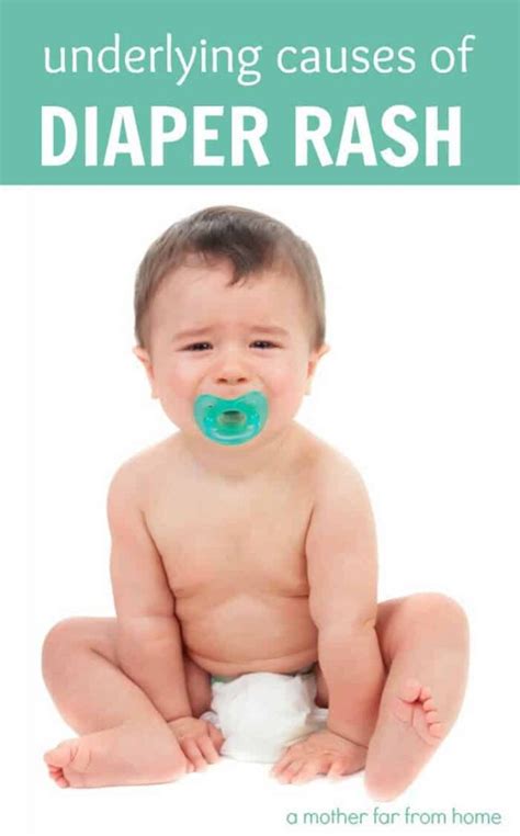 Common Diaper Rash Causes