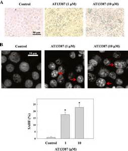 Characterization Of Senescence Phenotypes In At13387 Treated C666 1