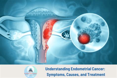 Endometrial Cancer Symptoms Causes And Treatment Dr Supratim Bhattacharyya