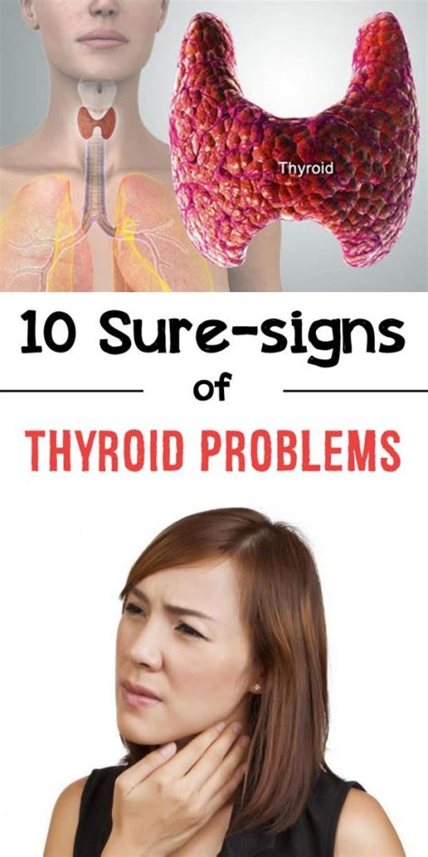 10 Sure Signs Of Thyroid Problems