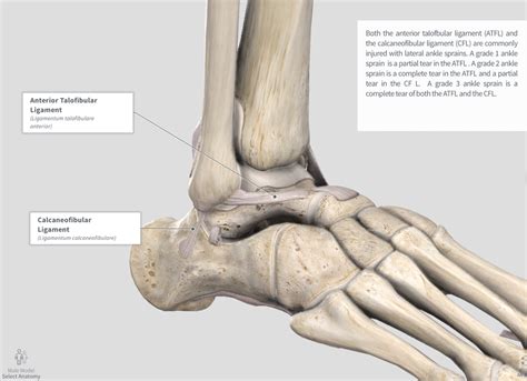 Lateral Ankle Sprains — Knowledge Central — Physiou