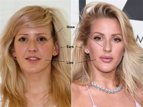 Ellie Goulding Plastic Surgery Before And After Photos Celeblenscom