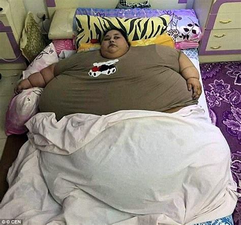 this egyptian woman shed over 300kg weight after 3 months in indian hospital