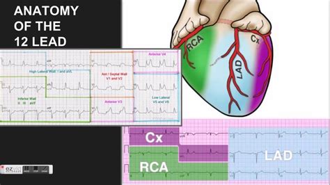 What Is A Stemi Really Part 1 Youtube