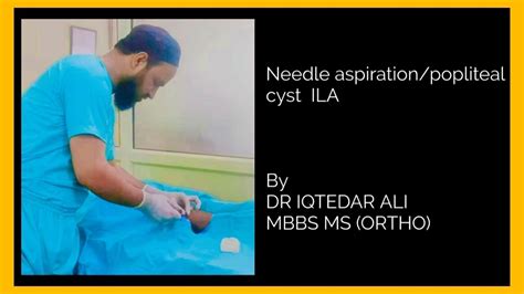 Needle Aspiration Popliteal Cyst Ila By Dr Iqtedar Ali Mbbs Ms Ortho Youtube