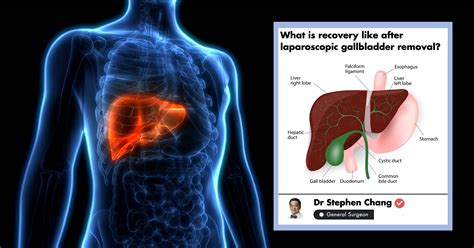 Gallbladder Burning Sensation How Do I Know If Pain Is Caused By My