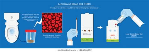 Fecal Ocult Blood Test Polymed Lab