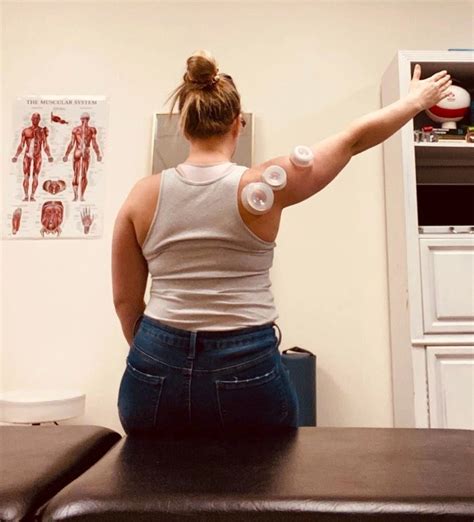 understanding cupping therapy the benefits and how it works