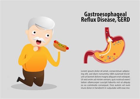 Premium Vector Gastro Esophageal Reflux Disease Gerd