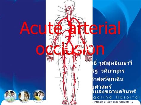Icd 10 Code For Arterial Occlusion Lower Extremity