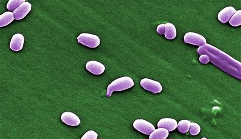 Gram Positive Endospore Forming Rods