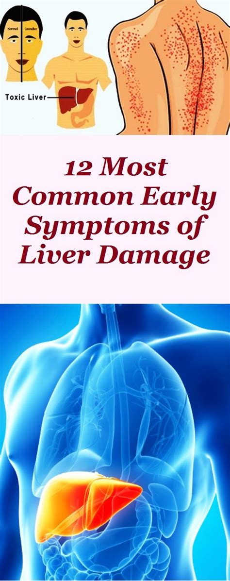 Most Common Early Symptoms Of Liver Damage Health