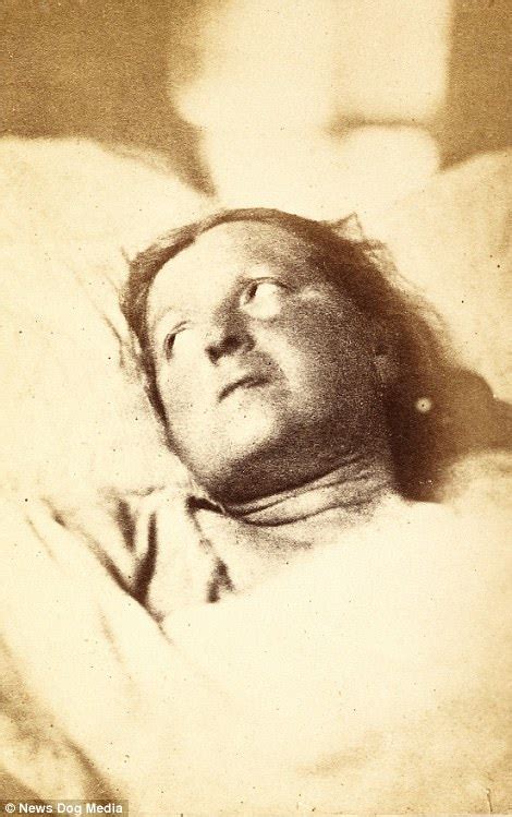 Hysteria Patients In 1870s Paris Revealed In Pictures Daily Mail Online
