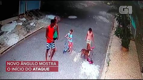 Novas Imagens Mostram Outros Momentos De Ataque De Pitbull A Menino No