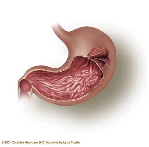 Find Out About The Gastric Layers