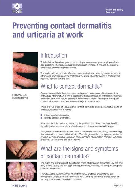 Preventing Contact Dermatitis And Urticaria At Work Indg233 Docslib