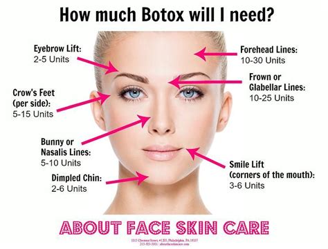 Botox Botox Cosmetic Face Skin Care Botox Injection Sites