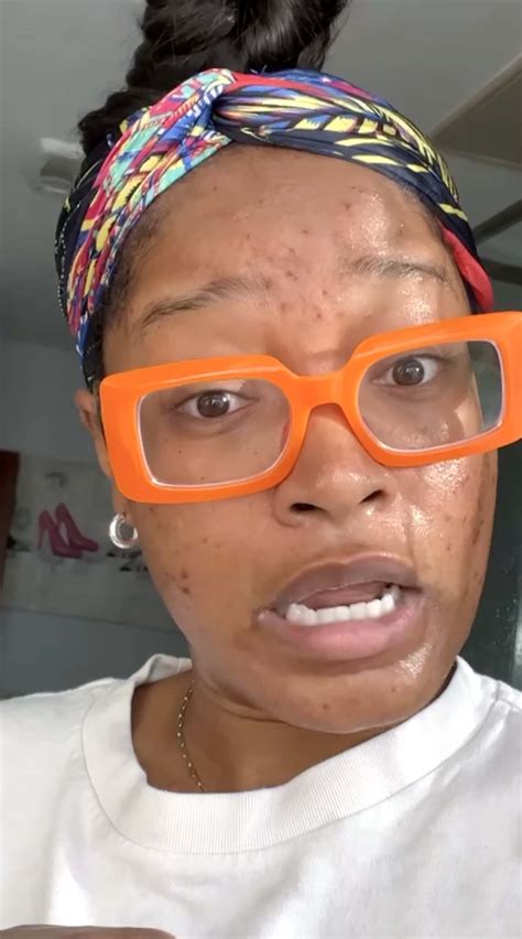Keke Palmer Gets Real About Her Struggle With Adult Acne Usweekly