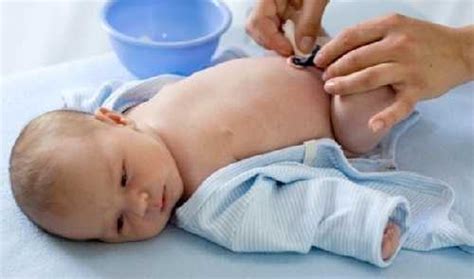 ️ Cara Merawat Tali Pusar Bayi Agar Tidak Infeksi Dan Segera Puput