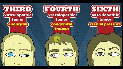 Cranial Nerve 34 And 6 Samarpan Physiotherapy Clinic Ahmedabad