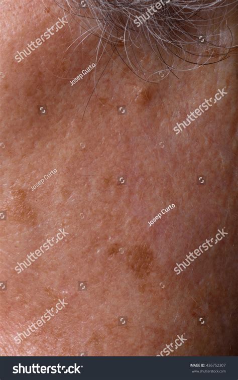Spots On The Face Of A Senior Woman Stock Photo 436752307 Shutterstock