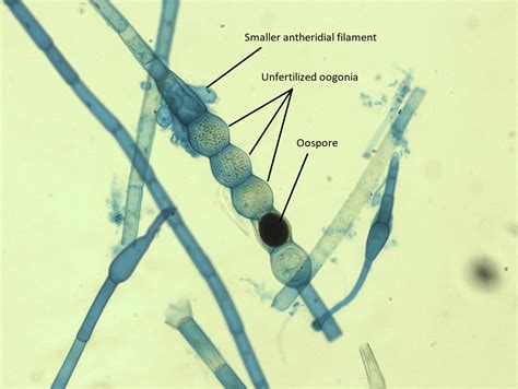Oedogonium Under Microscope Labeled