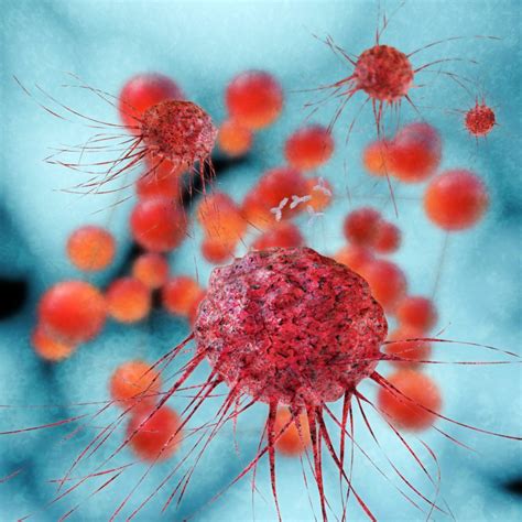 Krebs Warum Metastasen nach der Heilung zurückkehren Heimarbeit de