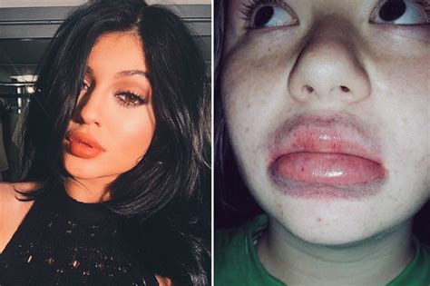 Kylie Jenner Finally Responds To The Ridiculous Lip Challenge Hitting