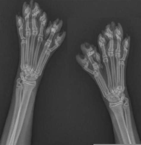 Another option is to do a google search; Polydactyl Cat | An X-ray of the paws of a polydactyl cat ...