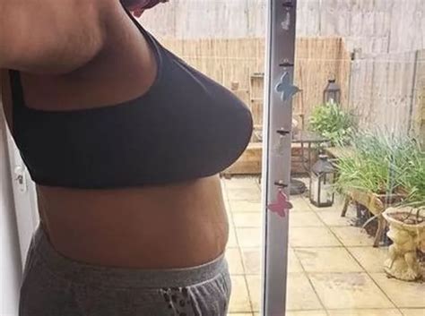 Plymouth Mum Desperate For Breast Reduction Surgery To Improve Her
