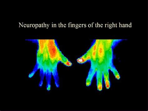 Thermography And Its Use In Cancer Care Conners Clinicconners Clinic