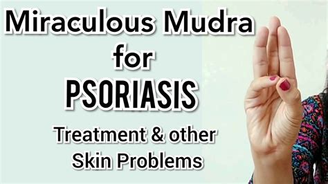 Yoga Mudra For Psoriasis Problems Mudra For Skin Dryness Youtube