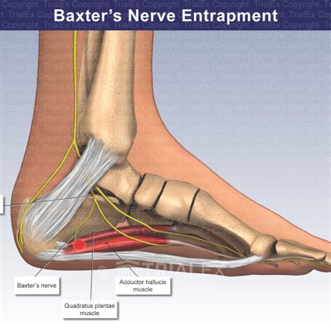 Baxters Nerve Entrapment Trial Exhibits Inc
