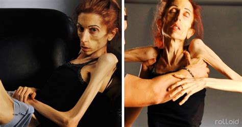 9 Imágenes De La Transformación De La Actriz Que Ganó A La Anorexia Haciéndose Viral