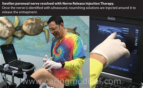 Nerve Release And Regeneration Injection Therapy