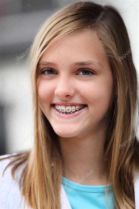 Young Caucasian Teen Girl Portrait With Dental Teeth Braces Stock Photo 054