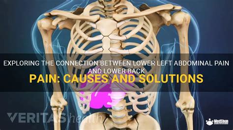 Exploring The Connection Between Lower Left Abdominal Pain And Lower Back Pain Causes And