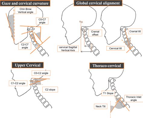 Definitions Of Head And Cervical Parameters Download Scientific Diagram