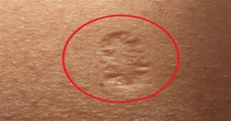 Do You Know The Truth Behind The Small Scar On The Upper Left Arm And