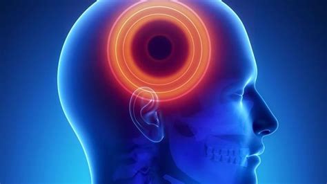 Sakit kepala adalah keluhan yang kerap dirasakan banyak orang. Kenali Jenis Sakit Kepala yang Kerap Menyerang Anda ...