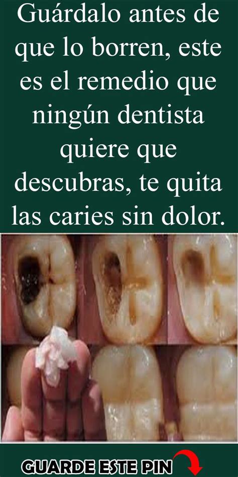 Lee Esto Antes De Que Lo Quiten Este Es El Remedio Que Los Dentista No