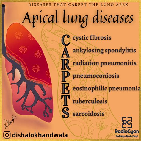 Causes Of Apical Lung Diseases Visual Mnemonics Radiogyan