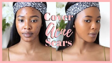 How To Cover Acne Scars Woc Youtube