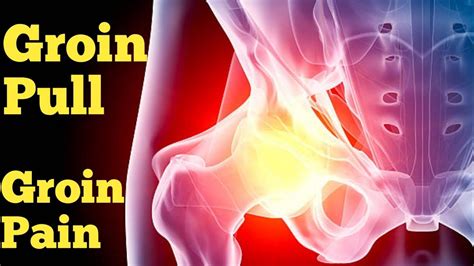 Groin Pull Groin Strain Symptoms Of Groin Pull Degrees Of Groin Pull Treatment And
