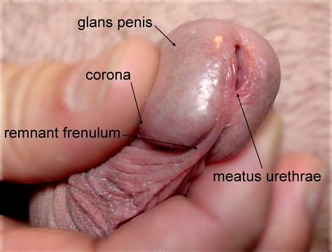 File Penis Frenulum Wikimedia Commons