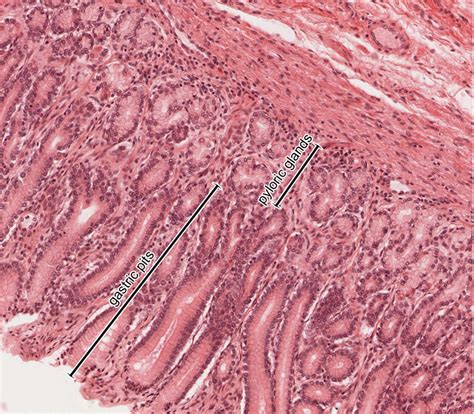 Histology Of The Esophagus And Stomach