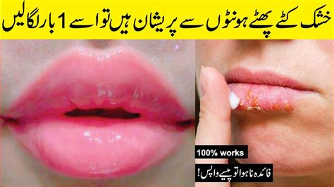 How To Get A Rid Of Dry Lips In Winter Smooth Skin Care In Winter2022