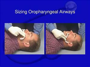 How To Measure Airway Size Reverasite