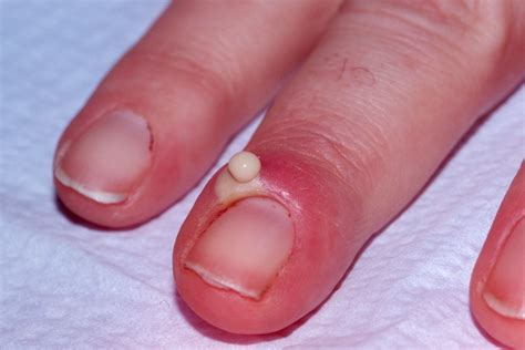15 Health Warnings Your Fingernails May Be Sending Bad Nails Nails