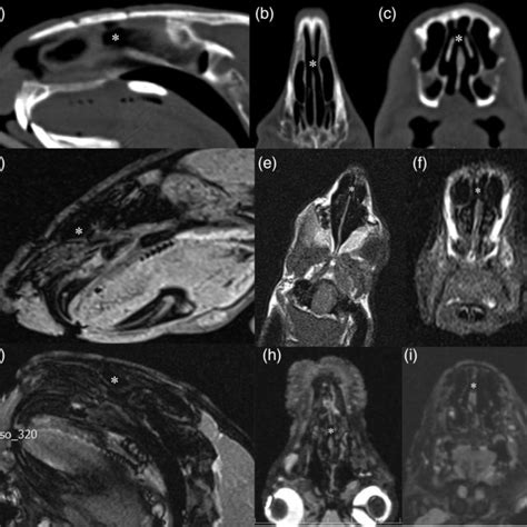 Ct Scans In The Sagittal A Axial B And Coronal C Sections Mri